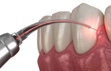 Denture